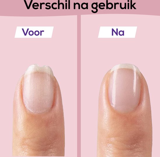 SafeCare – Geruisloos & Veilig – Elektrische baby nagelvijlset